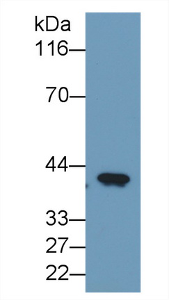 Monoclonal Antibody to Cluster Of Differentiation 147 (CD147)