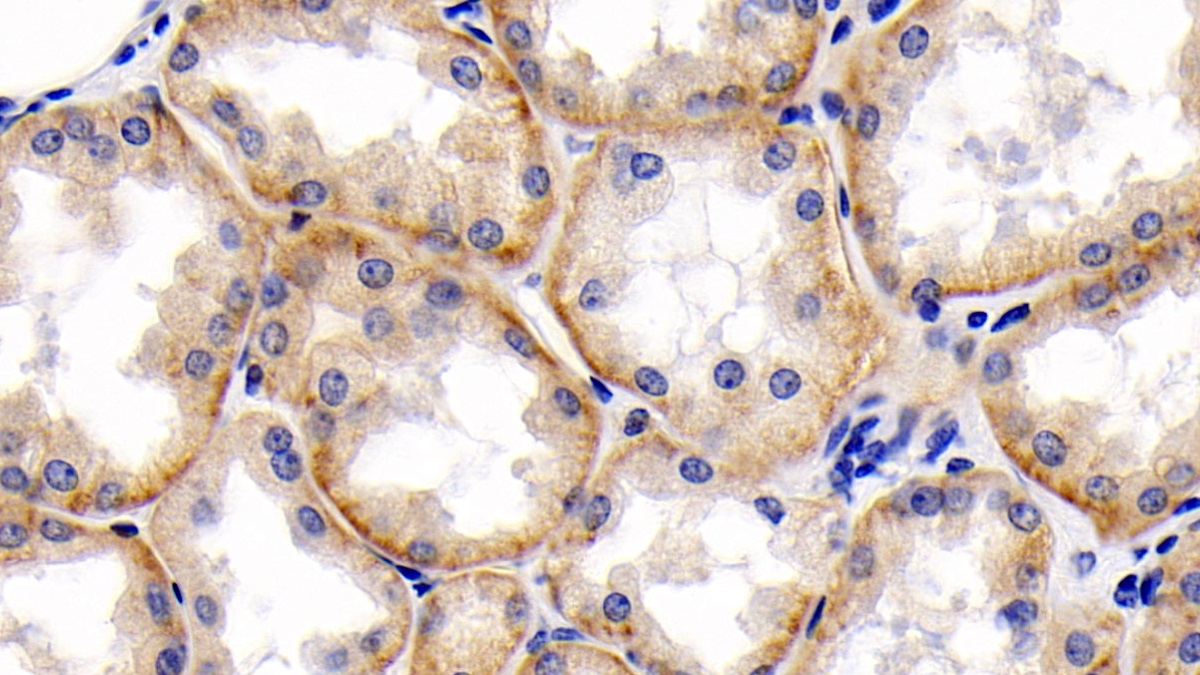 Monoclonal Antibody to Cluster Of Differentiation 147 (CD147)