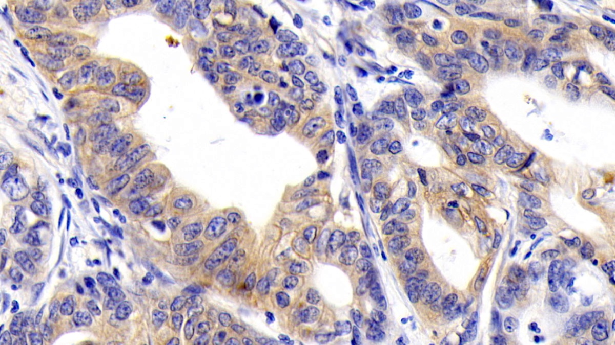 Monoclonal Antibody to Cluster Of Differentiation 147 (CD147)