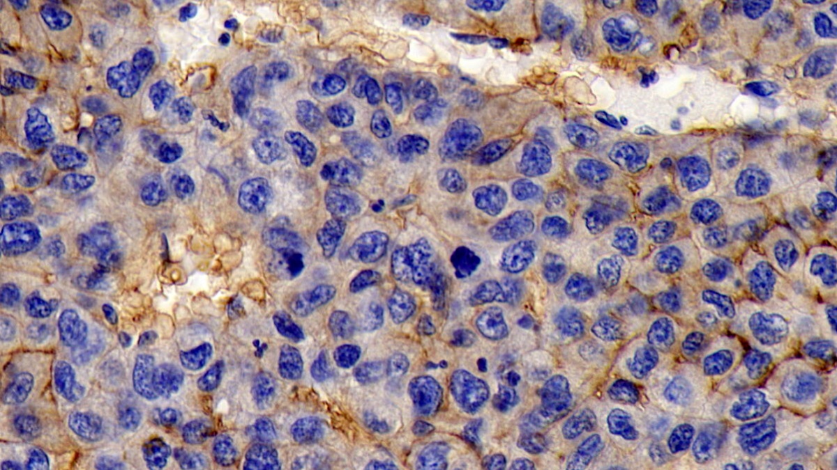 Monoclonal Antibody to Cluster Of Differentiation 147 (CD147)