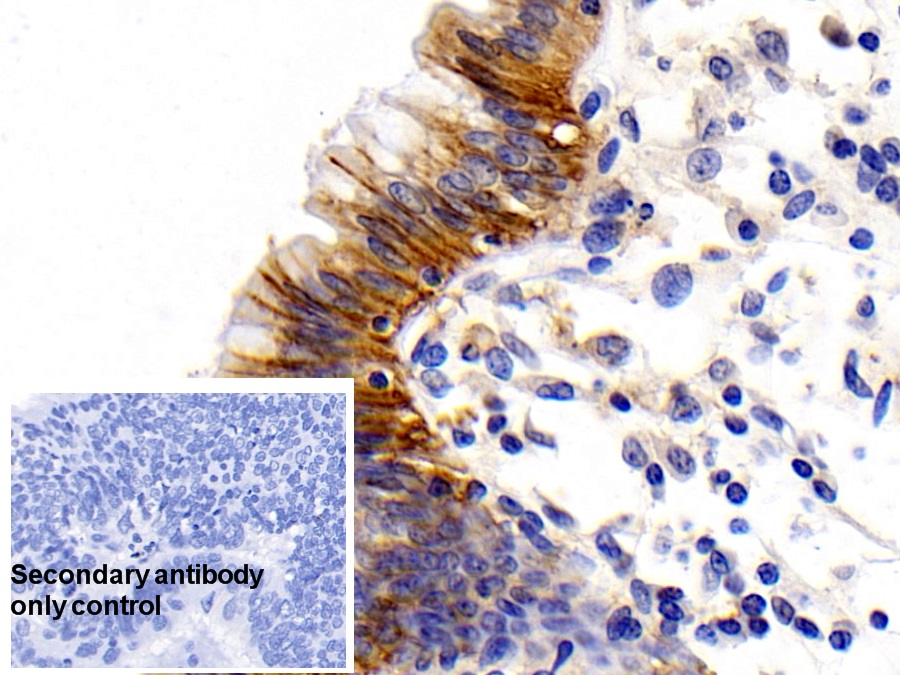 Monoclonal Antibody to Cluster Of Differentiation 147 (CD147)