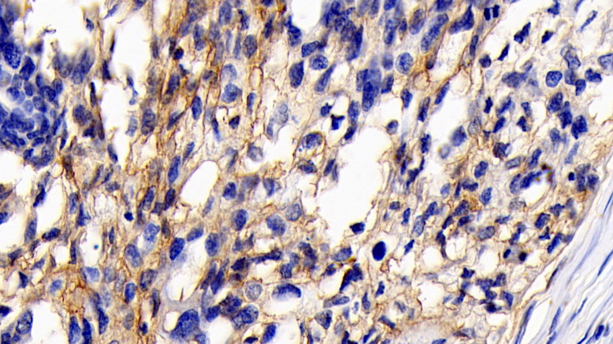 Monoclonal Antibody to Cluster Of Differentiation 147 (CD147)