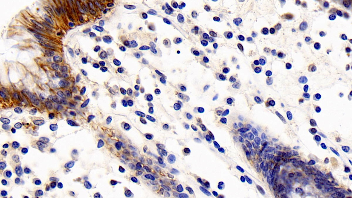 Monoclonal Antibody to Cluster Of Differentiation 147 (CD147)