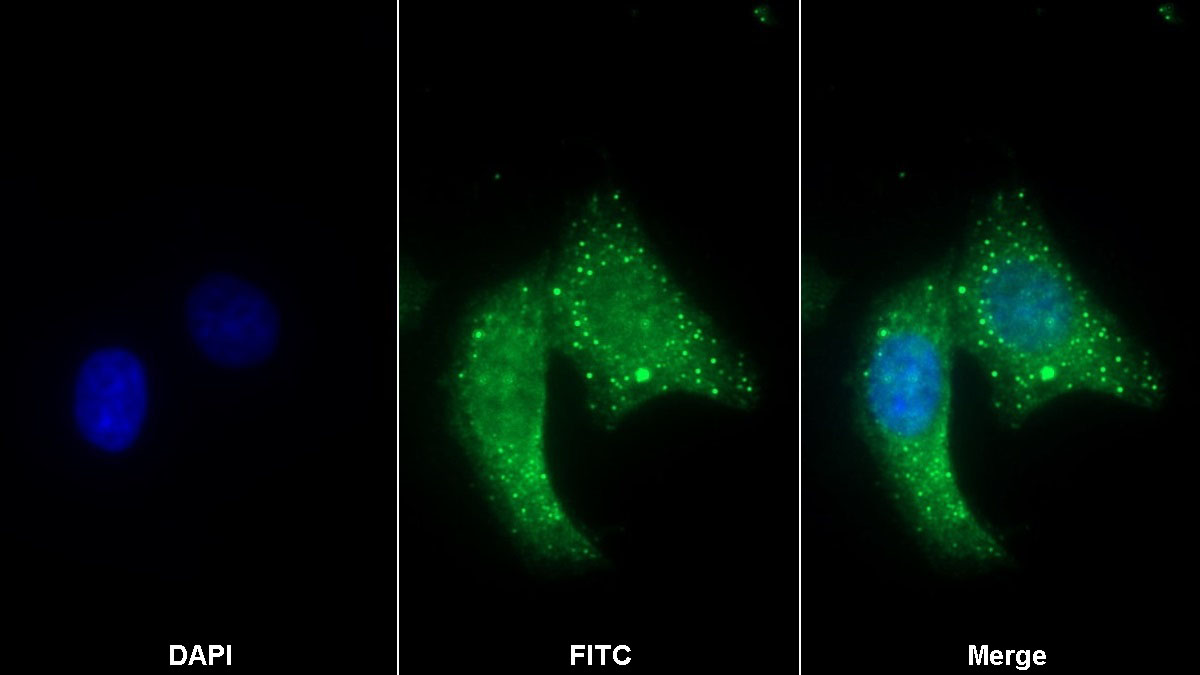 Monoclonal Antibody to Cluster Of Differentiation 147 (CD147)