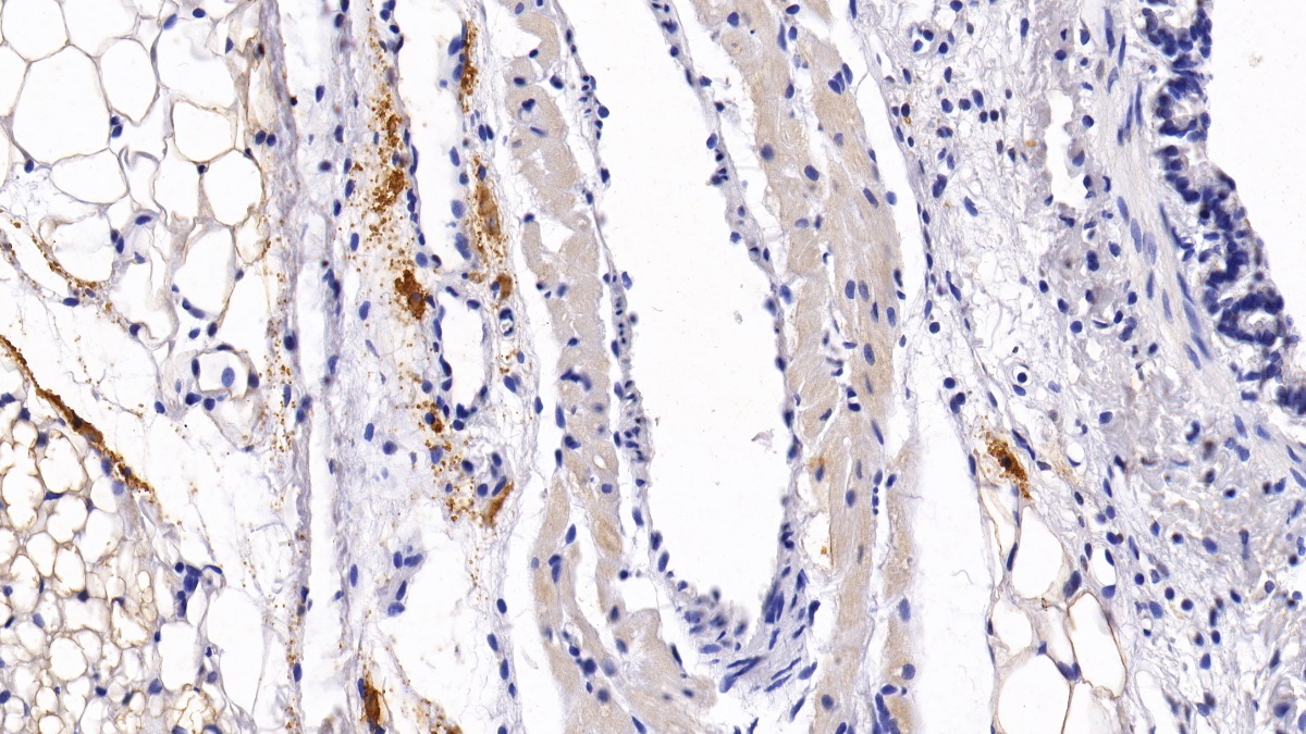 Monoclonal Antibody to Bone Marrow Stromal Cell Antigen 1 (BST1)