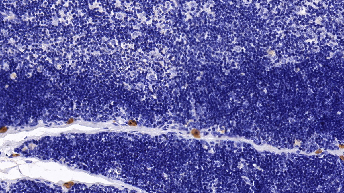 Monoclonal Antibody to Bone Marrow Stromal Cell Antigen 1 (BST1)