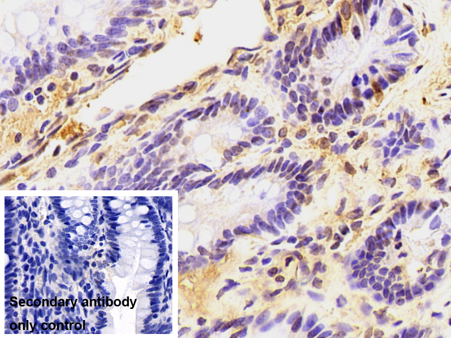 Monoclonal Antibody to Large Multifunctional Peptidase 7 (LMP7)