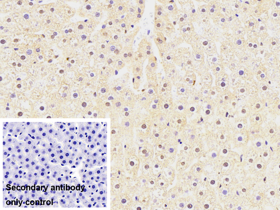 Monoclonal Antibody to Large Multifunctional Peptidase 7 (LMP7)