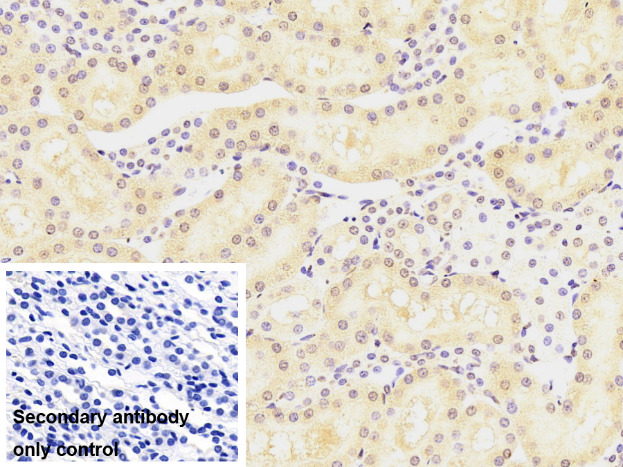 Monoclonal Antibody to Large Multifunctional Peptidase 7 (LMP7)