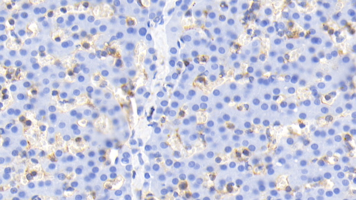 Monoclonal Antibody to Cofilin 1 (CFL1)