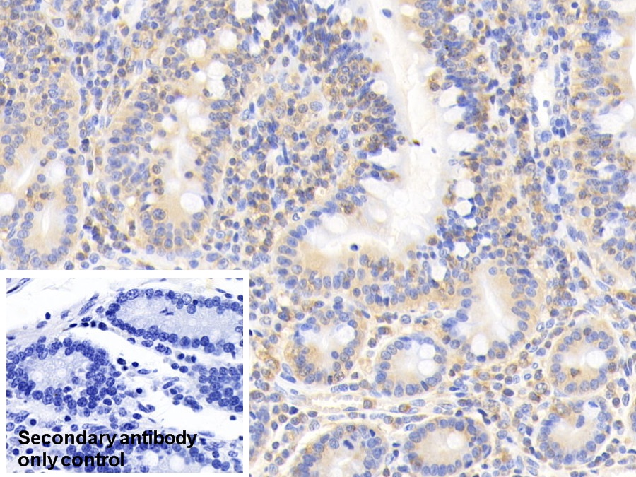 Monoclonal Antibody to Cofilin 1 (CFL1)