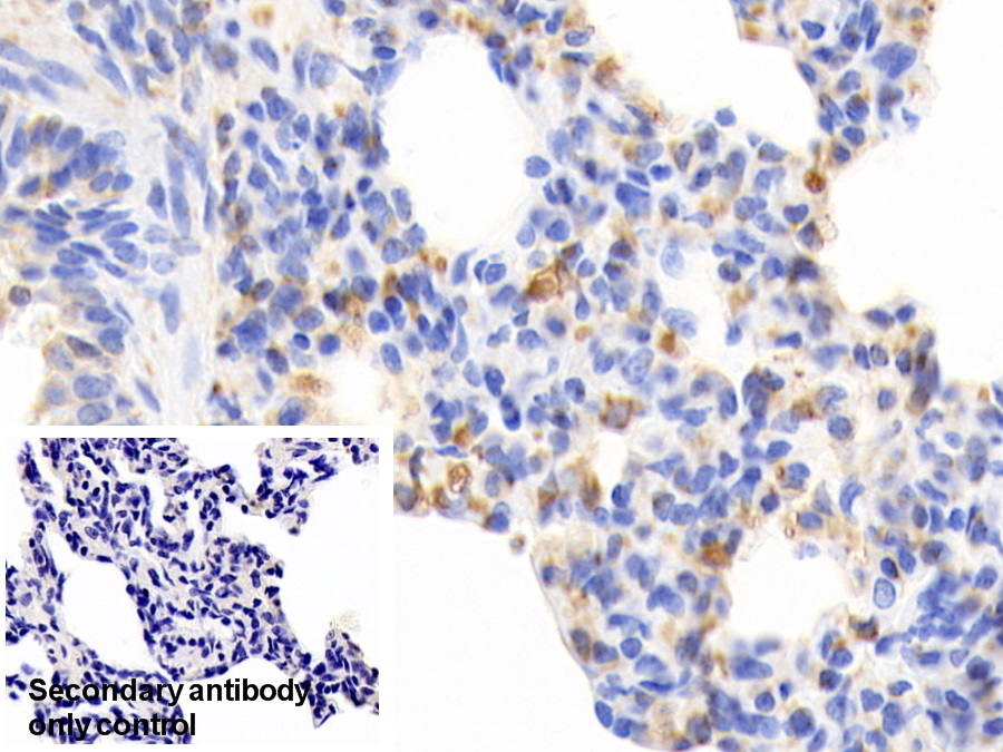 Monoclonal Antibody to Cofilin 1 (CFL1)