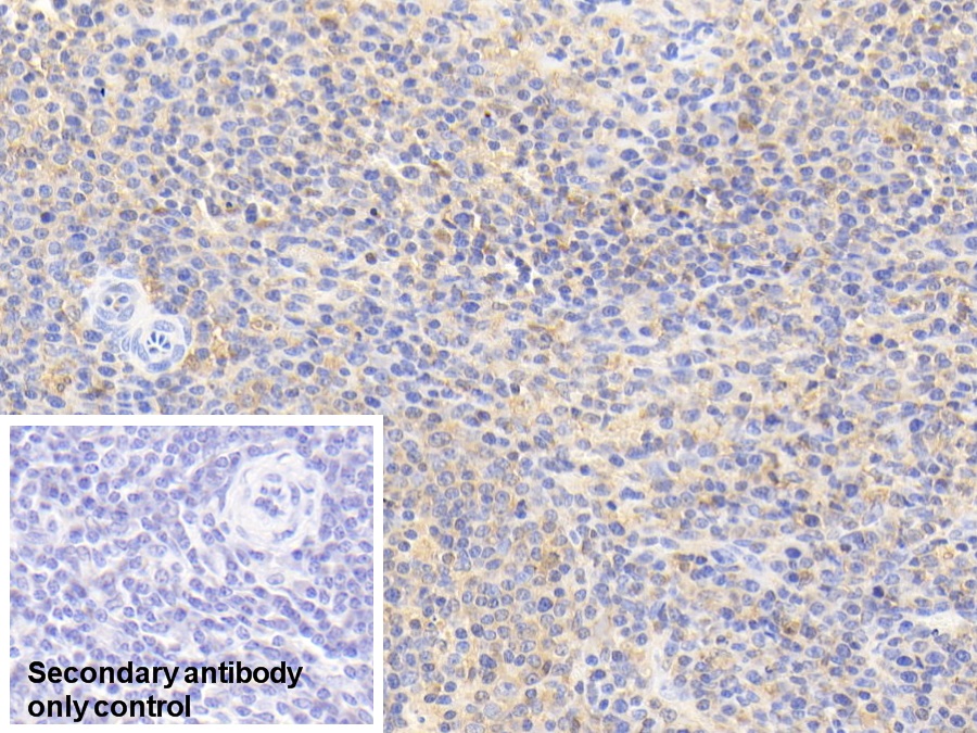 Monoclonal Antibody to Cofilin 1 (CFL1)