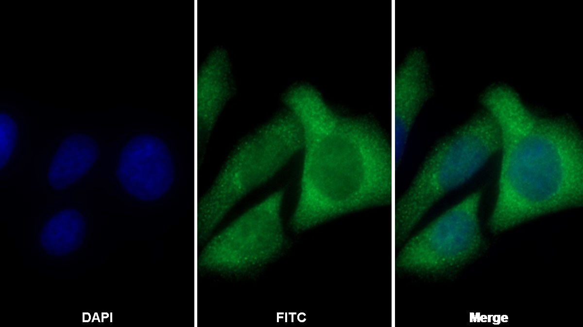 Monoclonal Antibody to Cofilin 1 (CFL1)