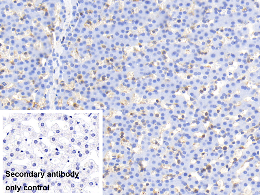 Monoclonal Antibody to Cofilin 1 (CFL1)