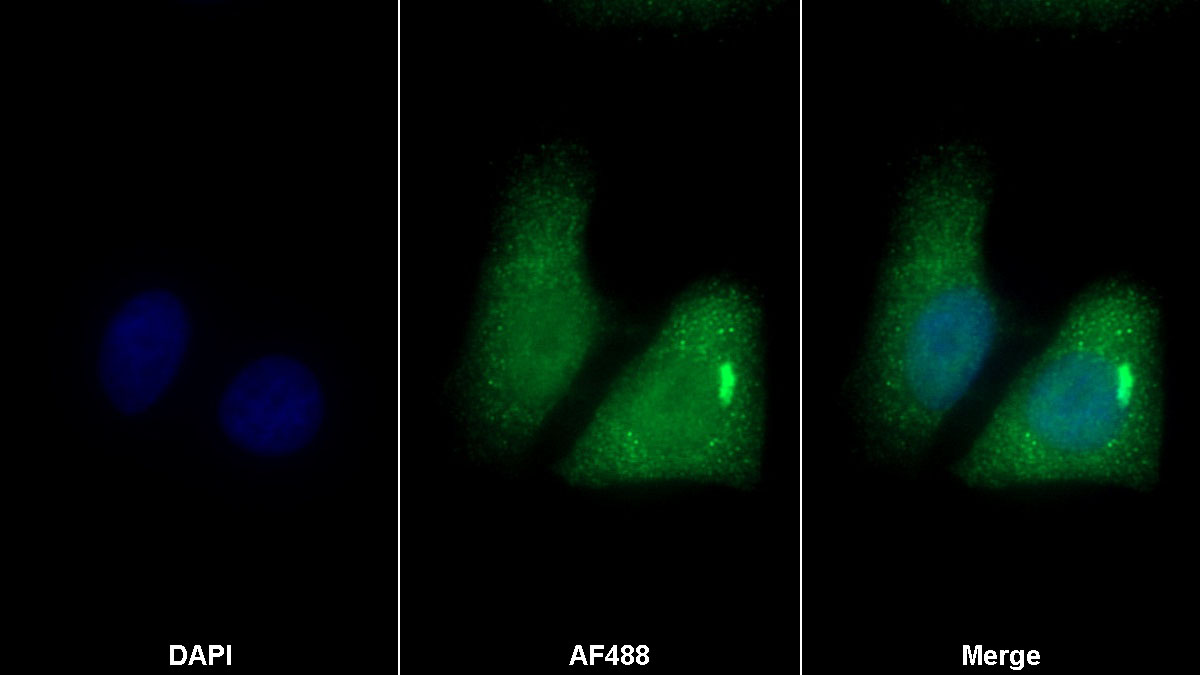 Monoclonal Antibody to Cofilin 1 (CFL1)