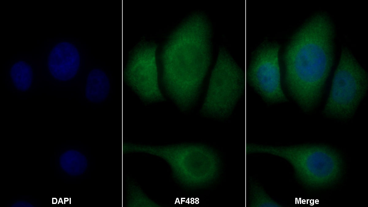 Monoclonal Antibody to Cofilin 1 (CFL1)