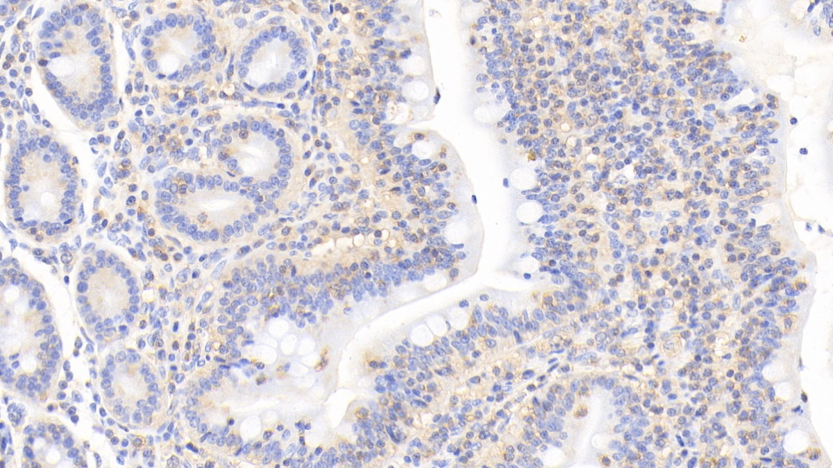 Monoclonal Antibody to Cofilin 1 (CFL1)