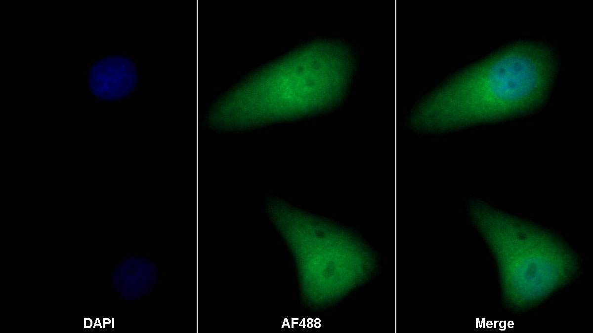 Monoclonal Antibody to Cofilin 1 (CFL1)