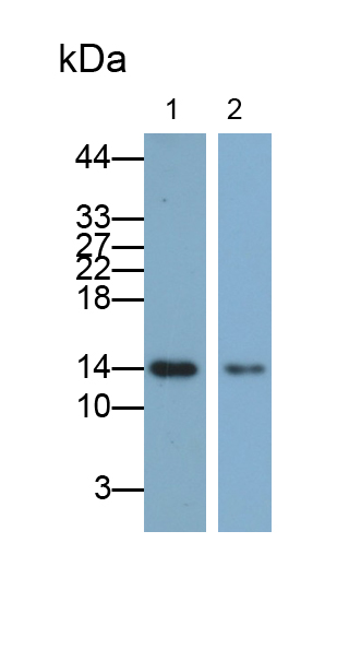 Monoclonal Antibody to Fatty Acid Binding Protein 1 (FABP1)
