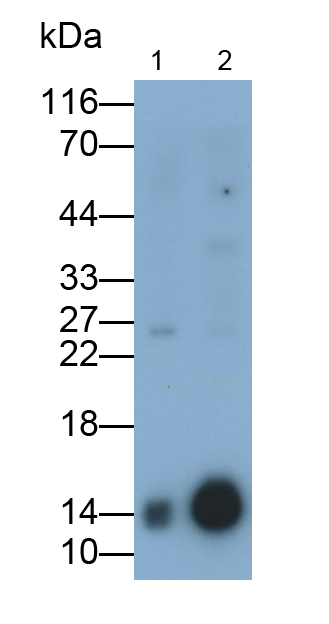 Monoclonal Antibody to Fatty Acid Binding Protein 1 (FABP1)
