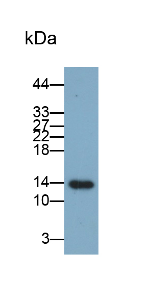 Monoclonal Antibody to Fatty Acid Binding Protein 1 (FABP1)