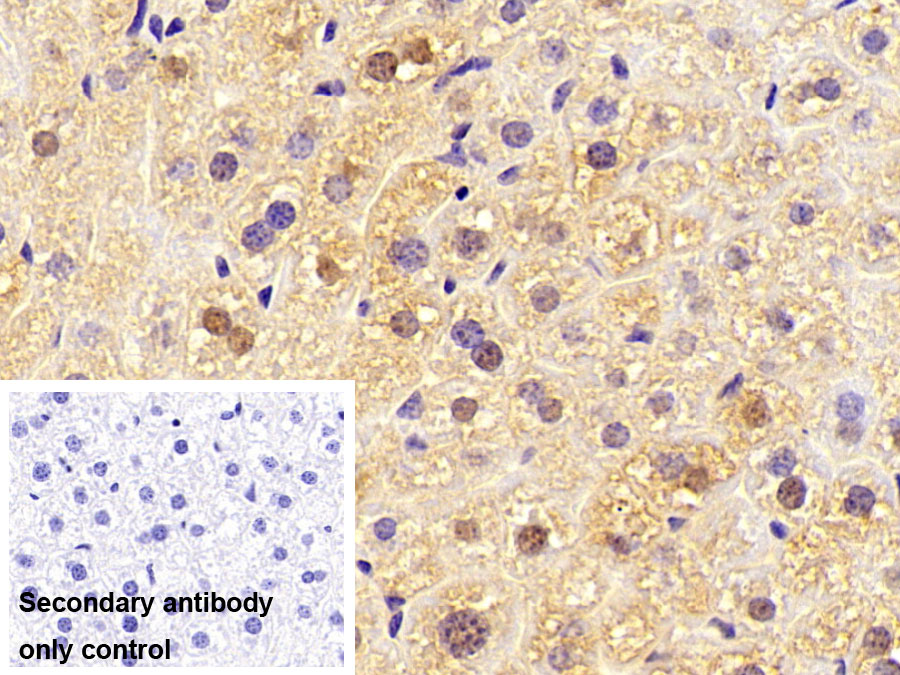 Monoclonal Antibody to Fatty Acid Binding Protein 1 (FABP1)