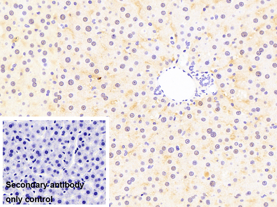 Monoclonal Antibody to Fatty Acid Binding Protein 1 (FABP1)