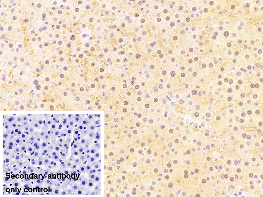 Monoclonal Antibody to Fatty Acid Binding Protein 1 (FABP1)