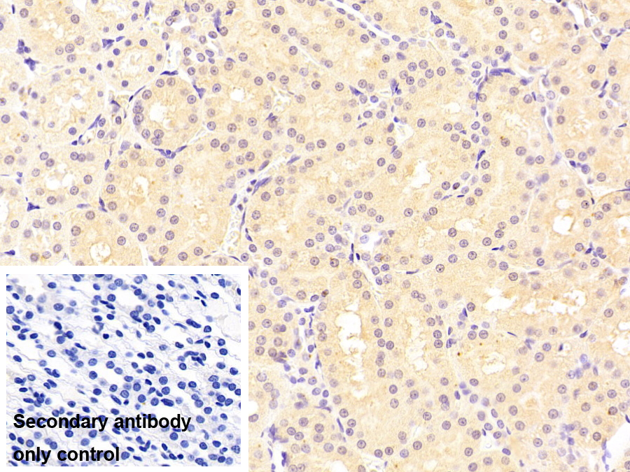 Monoclonal Antibody to Fatty Acid Binding Protein 1 (FABP1)