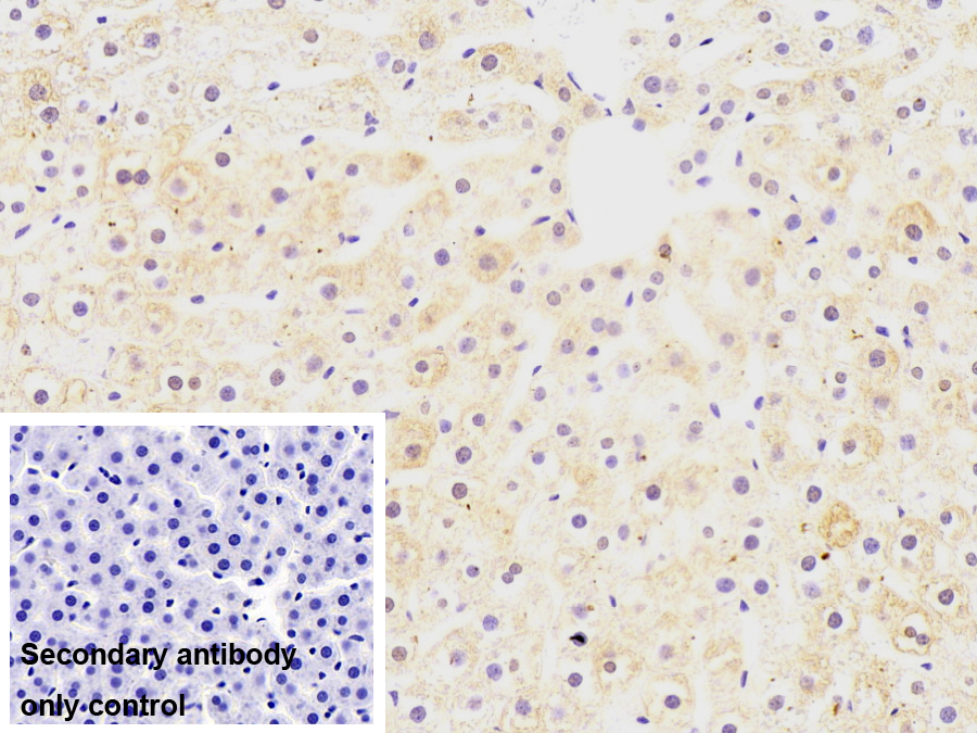 Monoclonal Antibody to Fatty Acid Binding Protein 1 (FABP1)