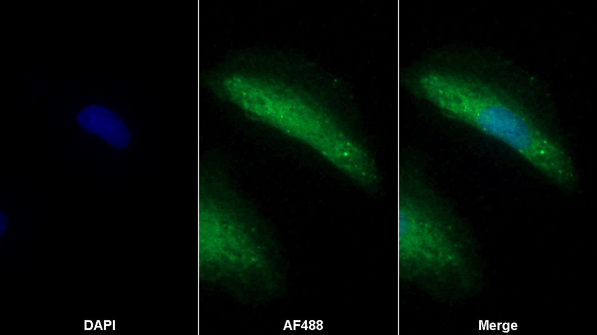 Monoclonal Antibody to C-Type Lectin Domain Family 4, Member K (CLEC4K)