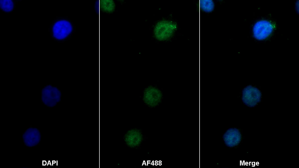 Monoclonal Antibody to Glucocorticoid Receptor (GR)