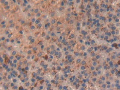 Monoclonal Antibody to Major Basic Protein (MBP)