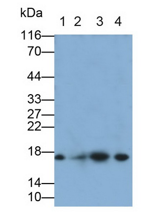 Monoclonal Antibody to Interleukin 21 (IL21)