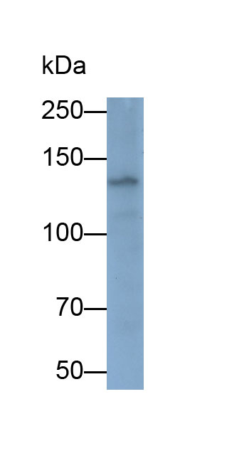 Monoclonal Antibody to Permeability Glycoprotein (Pgp)