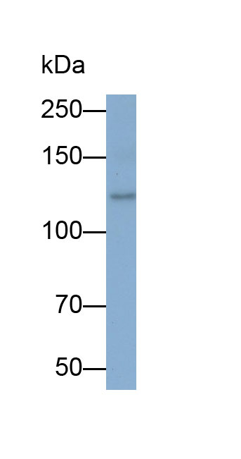 Monoclonal Antibody to Permeability Glycoprotein (Pgp)