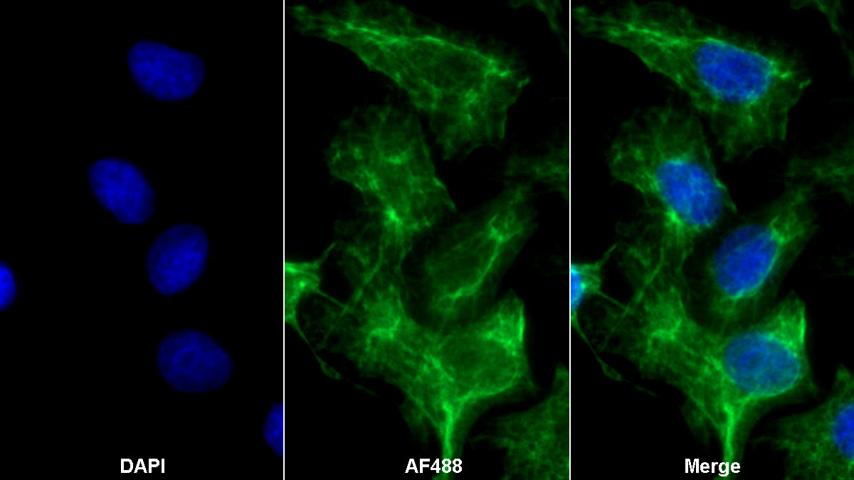 Monoclonal Antibody to Cytokeratin 10 (CK10)