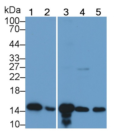 Monoclonal Antibody to Fatty Acid Binding Protein 4 (FABP4)