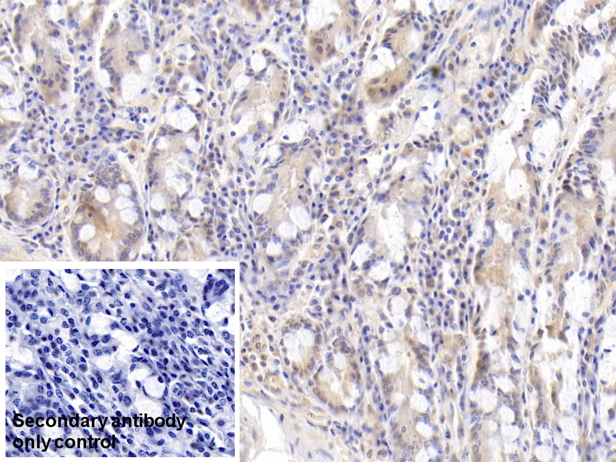 Monoclonal Antibody to Fatty Acid Binding Protein 4 (FABP4)