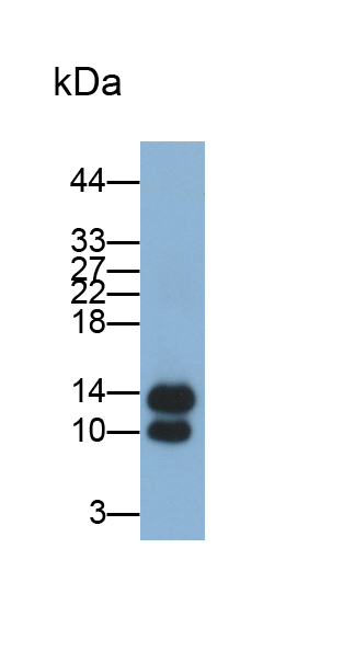 Monoclonal Antibody to Fatty Acid Binding Protein 4 (FABP4)