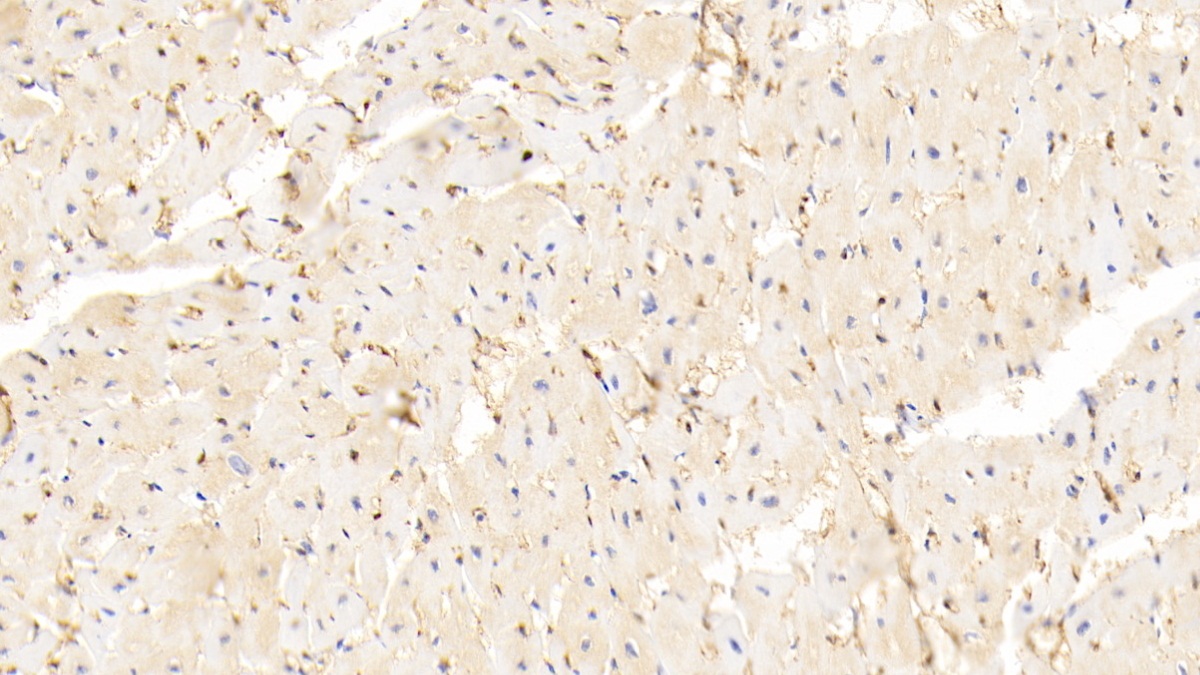 Monoclonal Antibody to Fatty Acid Binding Protein 4 (FABP4)