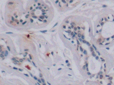 Monoclonal Antibody to Vascular Endothelial Growth Factor 165 (VEGF165)