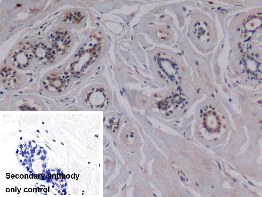 Monoclonal Antibody to Vascular Endothelial Growth Factor 165 (VEGF165)