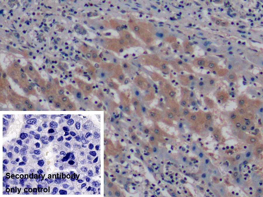 Monoclonal Antibody to Vascular Endothelial Growth Factor 165 (VEGF165)