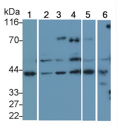 Monoclonal Antibody to Vascular Endothelial Growth Factor 165 (VEGF165)