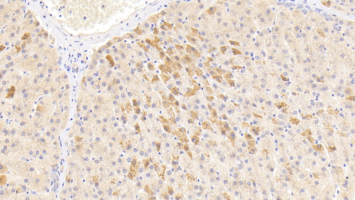 Monoclonal Antibody to Alpha-1-Antitrypsin (a1AT)