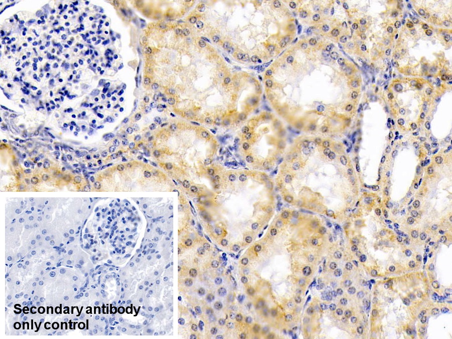 Monoclonal Antibody to Alpha-1-Antitrypsin (a1AT)