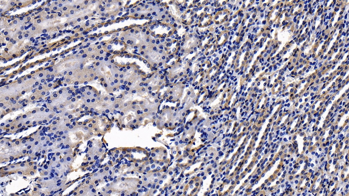 Monoclonal Antibody to Alpha-1-Antitrypsin (a1AT)