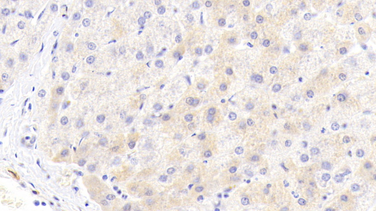 Monoclonal Antibody to Alpha-1-Antitrypsin (a1AT)